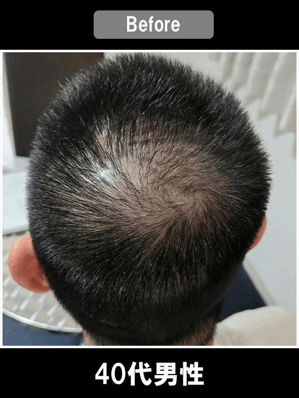 30万発 Before/After