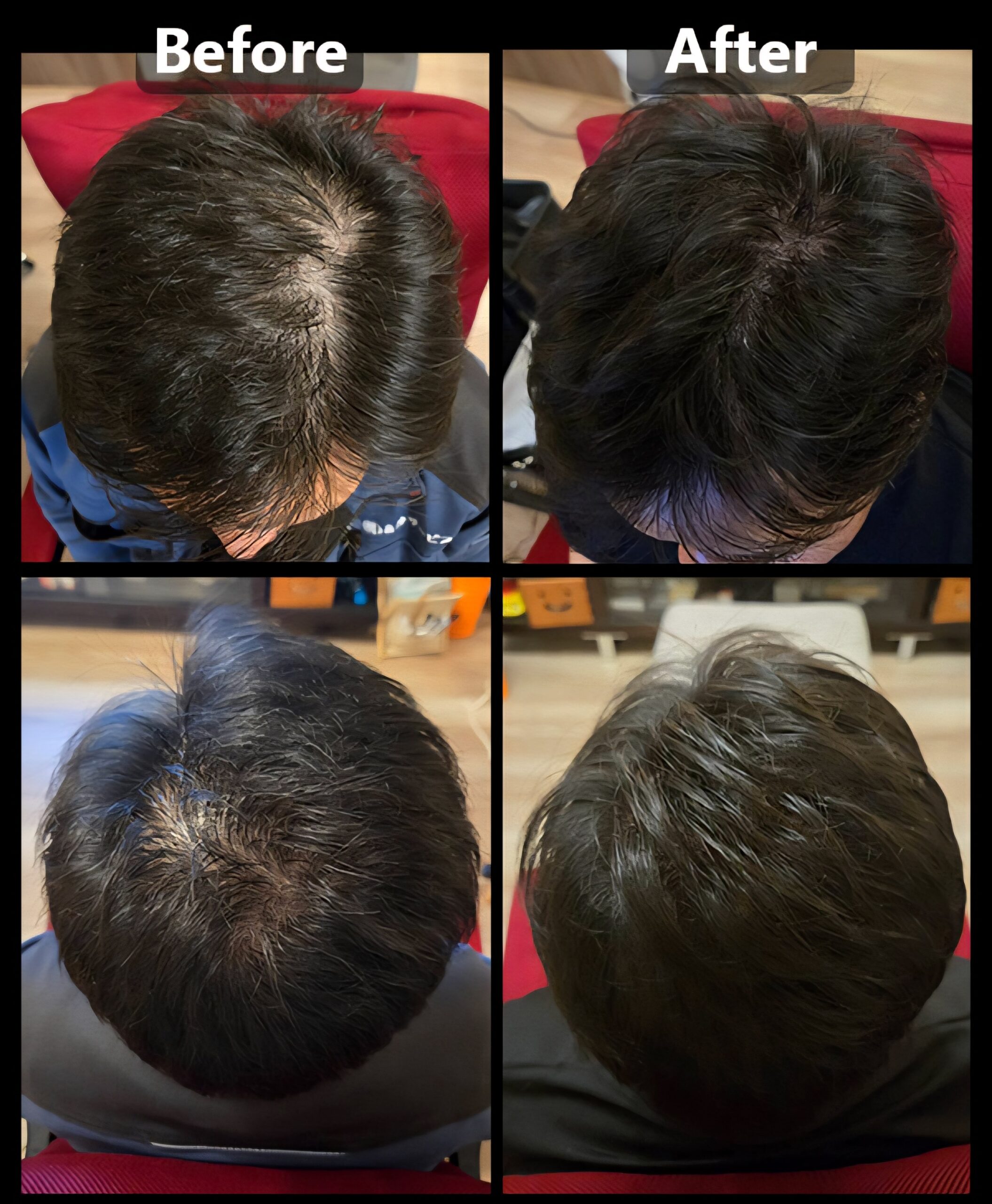 25万発 Before/After
